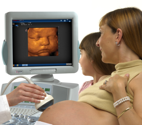 Color Ultrasound Pictures